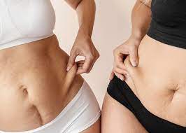Mommy Makeover para diferentes tipos de corpo
