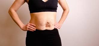 O que é uma Mommy Makeover