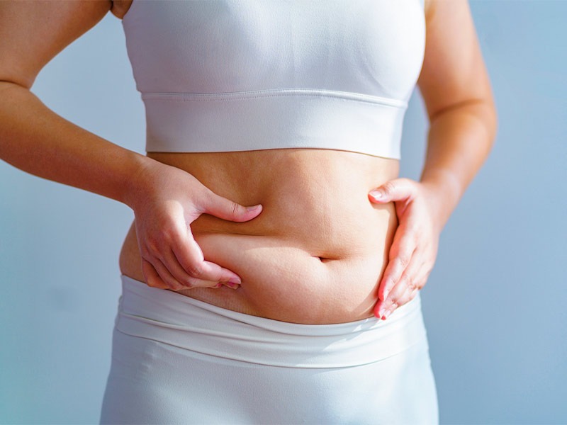 Recuperação da Mommy Makeover