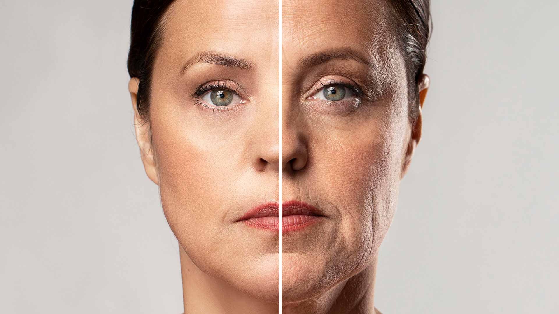 o ácido polilático é a melhor opção para você?