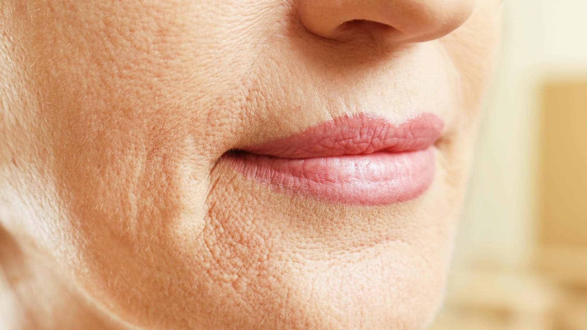 o ácido polilático é a melhor opção para você?